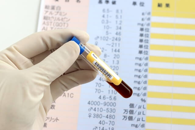 風疹 抗体 検査 数値