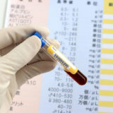 血液検査